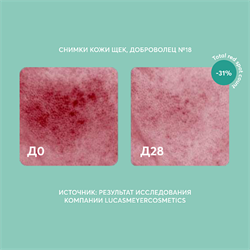 Сыворотка для кожи, склонной к покраснениям и пигментации "Azelaic Acid" - фото 10866